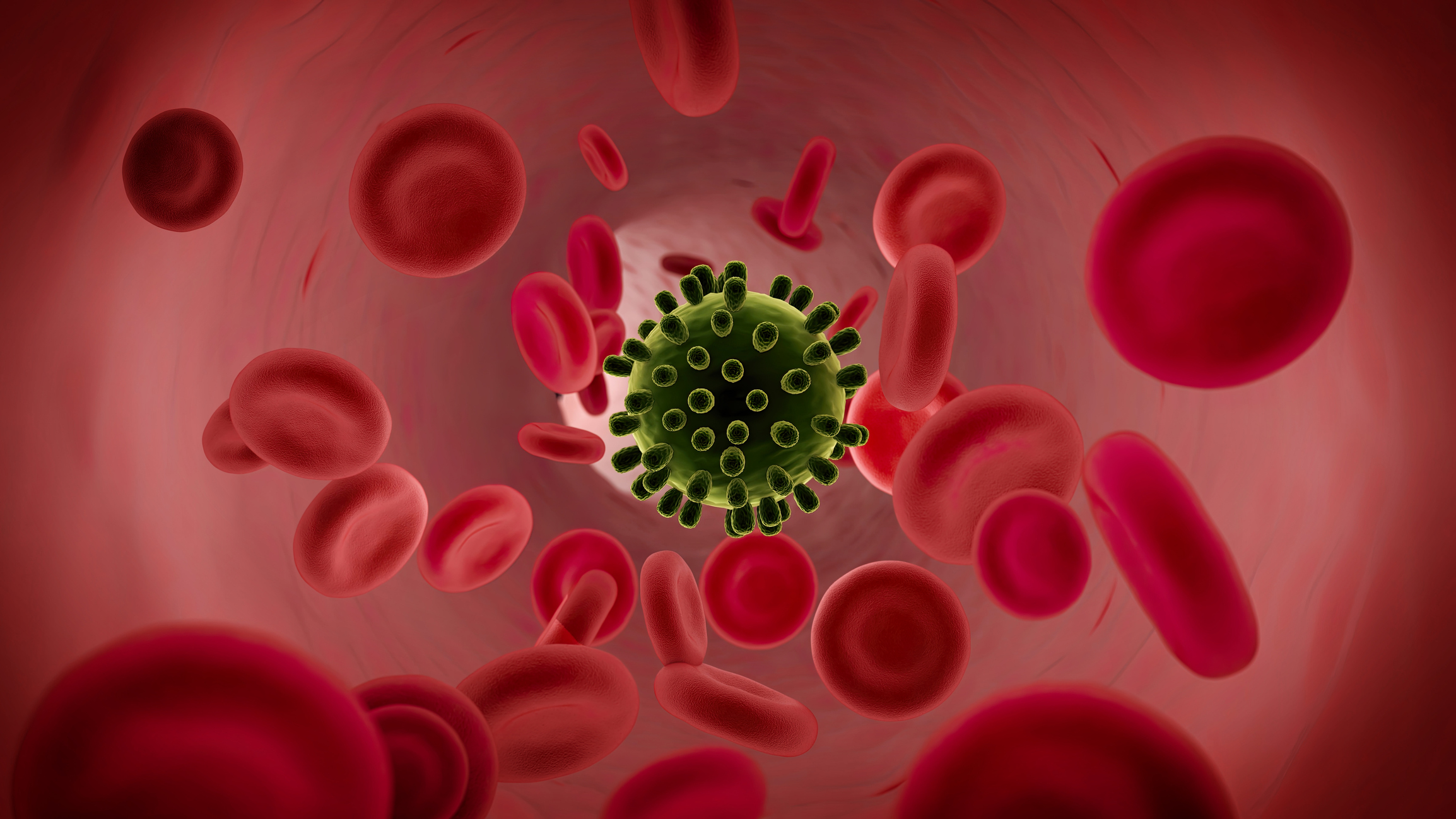 Newly discovered cause of heart attack hides in plaque